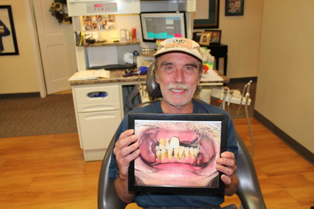 patient before dental implants