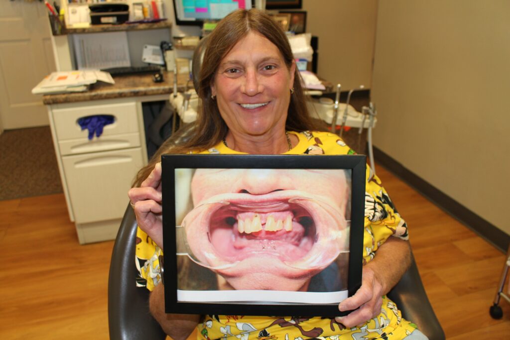 patient holding a before picture of dental implants